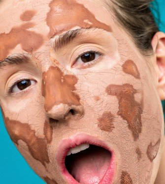 Οι κορυφαίες 6 θεραπείες για το ξηρό δέρμα στο πρόσωπο
